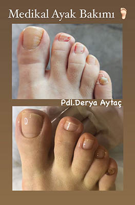 gallery img